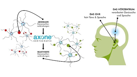 Axone Hörtherapie Grafik